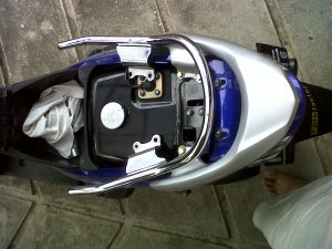 beda ukuran behel lawas - baru